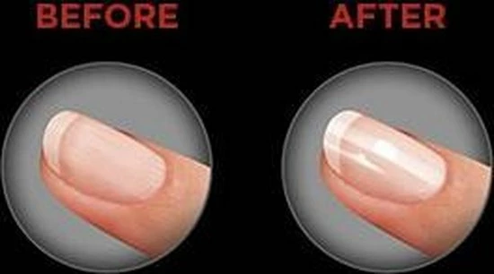 Revlon RVSP3525UKE - Nagel Buffer 5 Revlon RVSP3525UKE - Nagel Buffer - Image 3