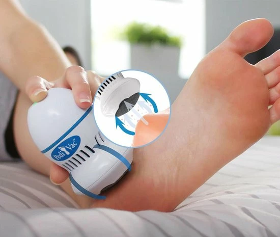 Mediashop PediVac Eeltverwijderaar - Elektrische Voet Vijl - Voetvijl - Veilig - Zuigfunctie - Voetverzorging - USB Oplaadbaar 11 Mediashop PediVac Eeltverwijderaar - Elektrische Voet Vijl - Voetvijl - Veilig - Zuigfunctie - Voetverzorging - USB Oplaadbaar - Image 9