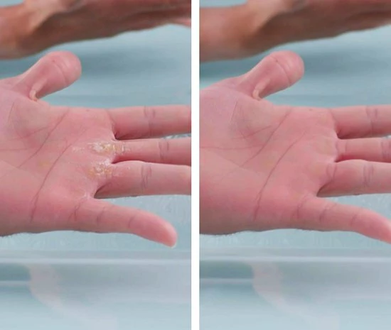 Mediashop PediVac Eeltverwijderaar - Elektrische Voet Vijl - Voetvijl - Veilig - Zuigfunctie - Voetverzorging - USB Oplaadbaar 5 Mediashop PediVac Eeltverwijderaar - Elektrische Voet Vijl - Voetvijl - Veilig - Zuigfunctie - Voetverzorging - USB Oplaadbaar - Image 3