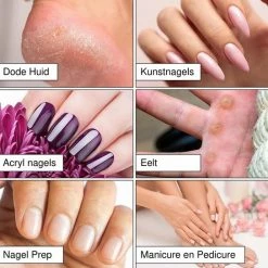 Merkloos Schuurrolletjes Nagelfrees - 180 Grit - 100 Stuks - Schuurrolletjes - Schuurrolletjes 180 - Schuurrol - Schuurrollen - Schuurrolletjes 180 - Schuurrollen 180 Grit - Schuurhulzen - Mandrel Bitje - Mandrel - Sanding Bands Nagels - Sanding Bands Nails -Lanaform Shop 550x544 23