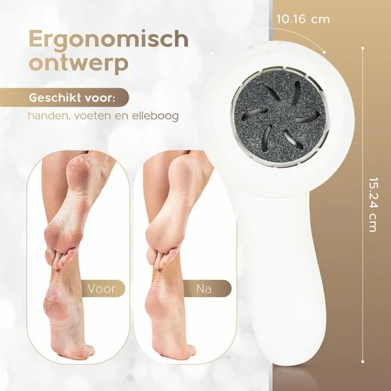 FootPedicure? - Eelt Verwijderaar Electrisch - Eeltvijl - Eelt Verwijderaar - Voetvijl 5 FootPedicure? - Eelt Verwijderaar Electrisch - Eeltvijl - Eelt Verwijderaar - Voetvijl - Image 3