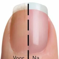 Jml My Mani Opzetstukken - Rollers - Set Van 6 9 Jml My Mani Opzetstukken - Rollers - Set Van 6 -Lanaform Shop 550x650 8