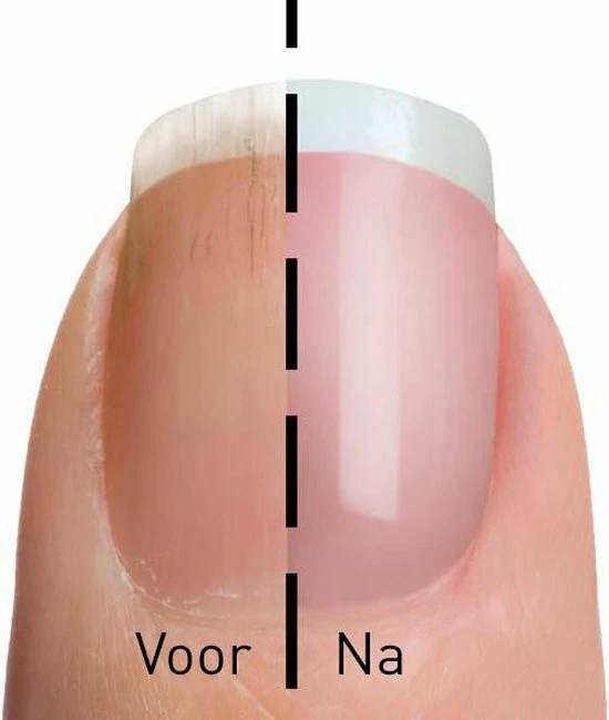 Jml My Mani Opzetstukken - Rollers - Set Van 6 5 Jml My Mani Opzetstukken - Rollers - Set Van 6 - Image 3